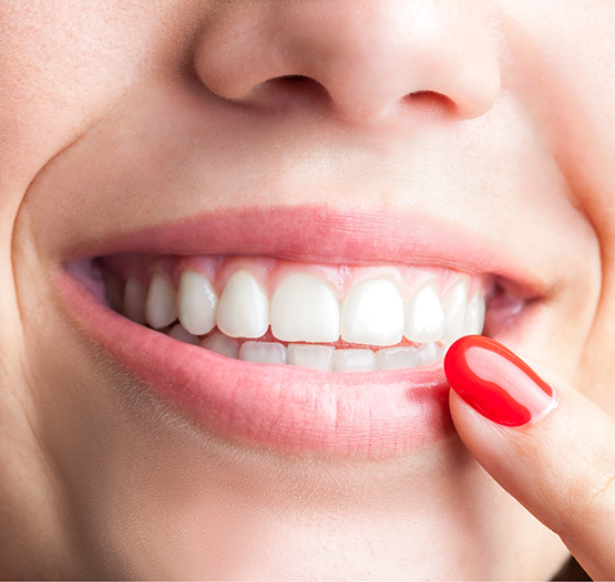 Smiling person pointing to their flawless teeth