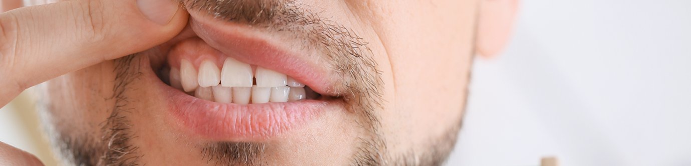 Man pointing to his gums after gum disease treatment in Spring