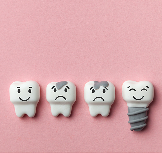 Illustration of a row of damaged frowning teeth and a smiling dental implant