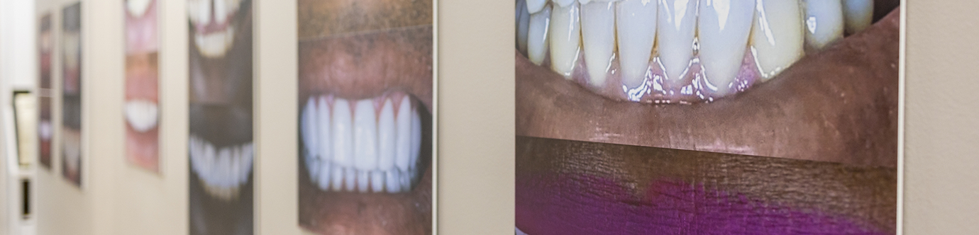 Several framed photos of smiles before and after dental services in Spring