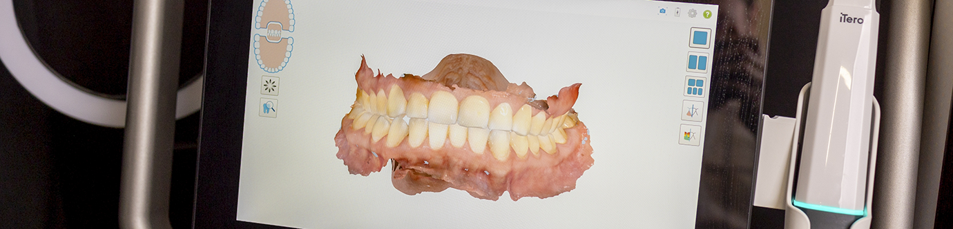 Monitor showing digital scans of a patient's teeth